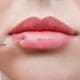 Dermal Lip Fillers: How Long They Last and When to Come Back